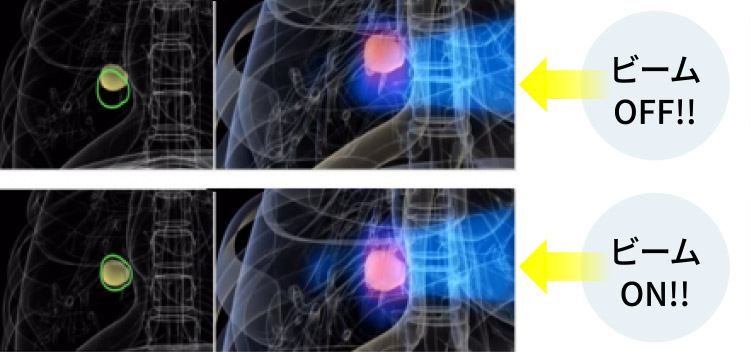 ビームOFF!!とビームON!!