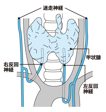 反回神経イメージイラスト