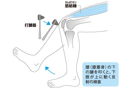 3月 歩きにくいのは腰の病気 せぼねセンター 磁気共鳴 Mr 専門技術者 Webマガジン 白いまど 聖隷浜松病院