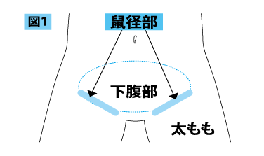 鼠径部の位置を示したイラスト