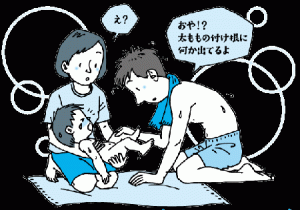 子供の鼠径ヘルニアを見つけた男性のイラスト