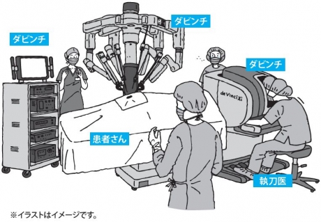 ロボット支援術イメージイラスト