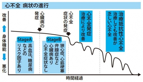 心不全病状の進行グラフ