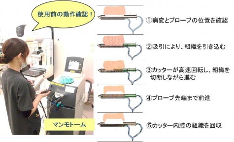 乳房生検のリスク