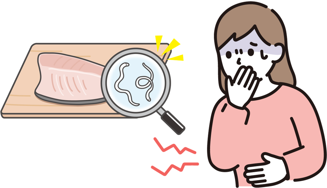 アニサキス症