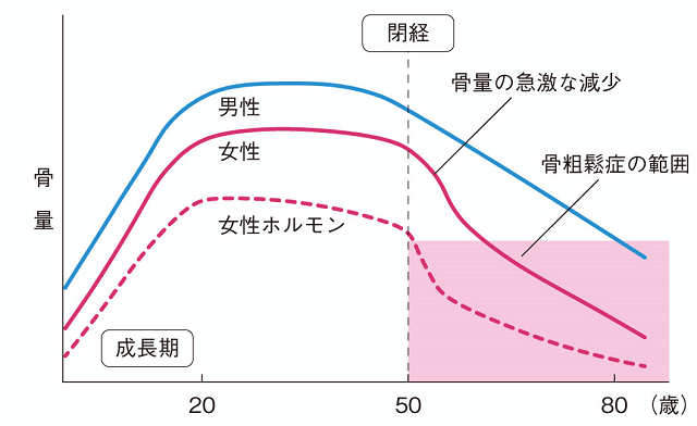 年齢と閉経に伴う骨量の変化（概念図）