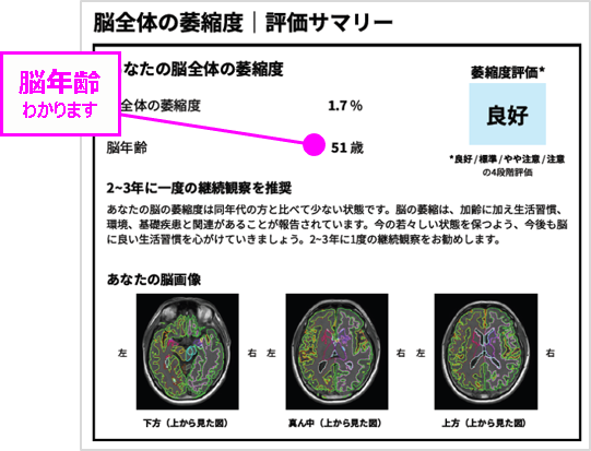 脳健康度AI解析レポート